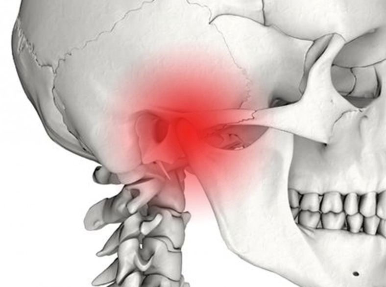 jaw joint surgery